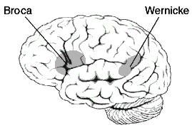 Two areas of the brain involved in Broca’s aphasia